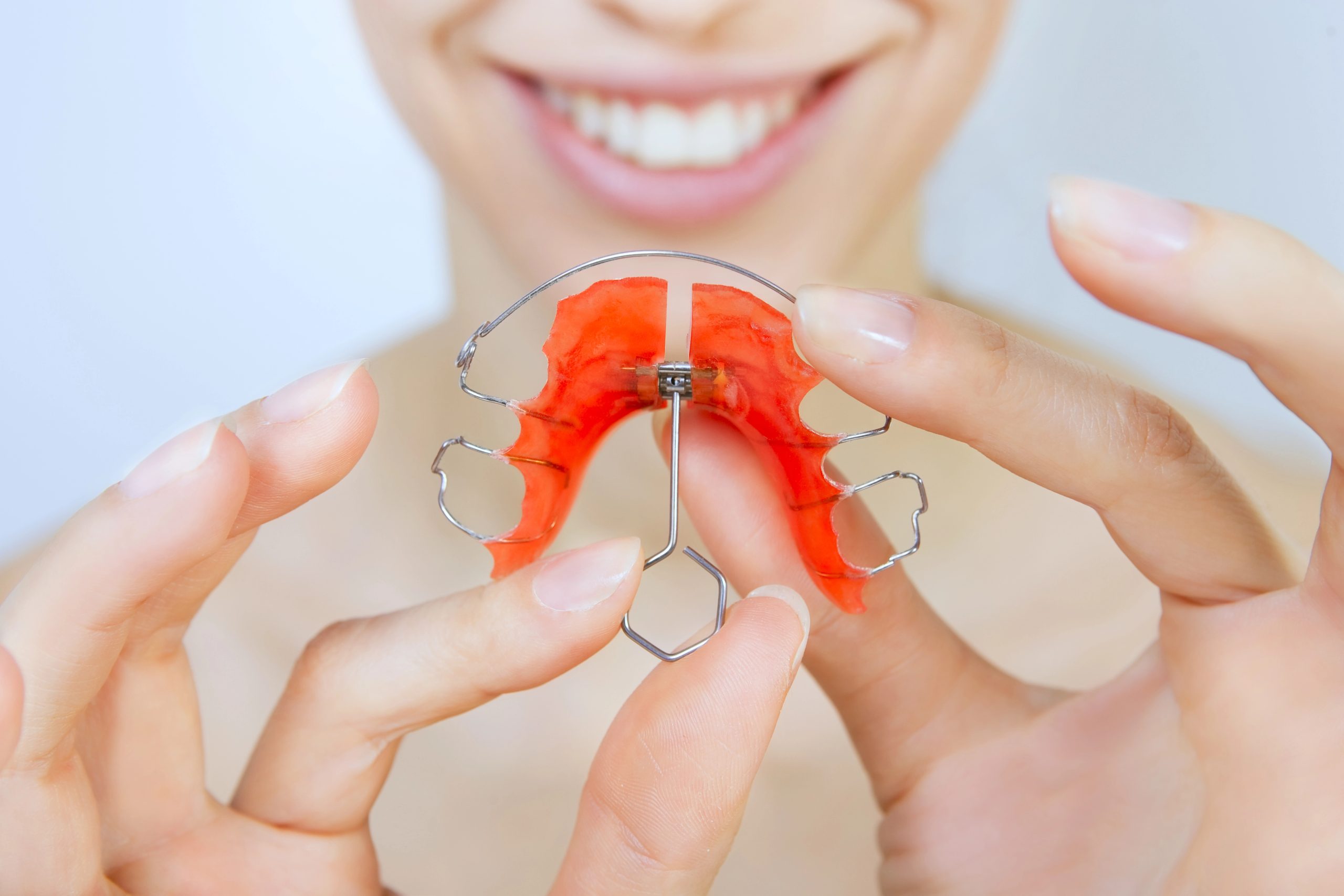 What Determines Retainer Costs?