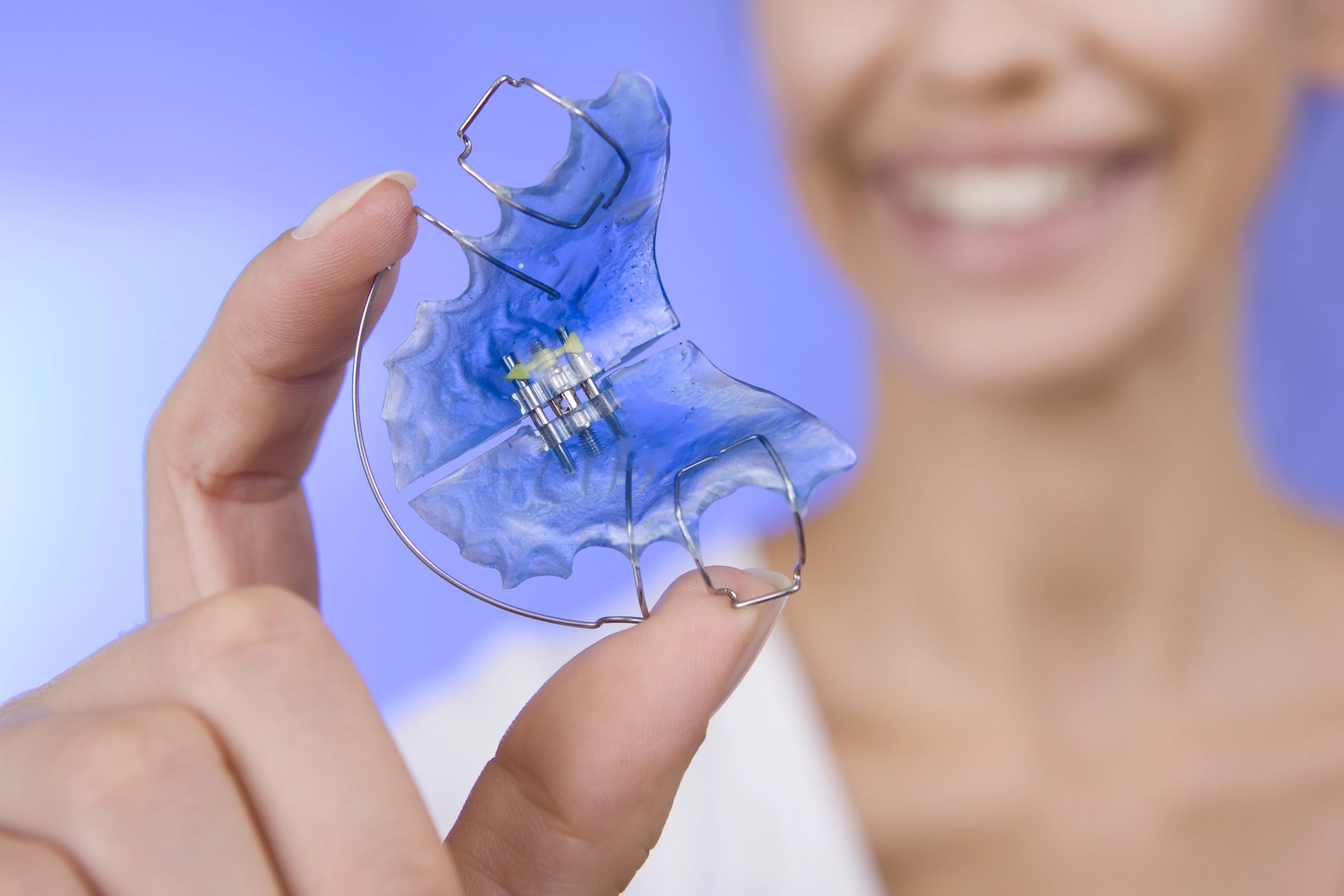 Why Retainers are Crucial After Braces